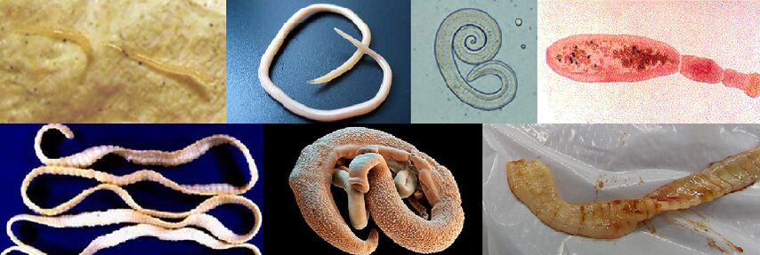 Διαφορετικοί τύποι παρασίτων