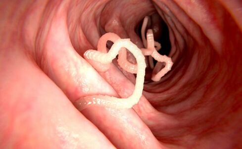 σκουλήκια στο ανθρώπινο σώμα