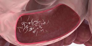 Η χρήση τριπλών για την κατάργηση των παρασίτων