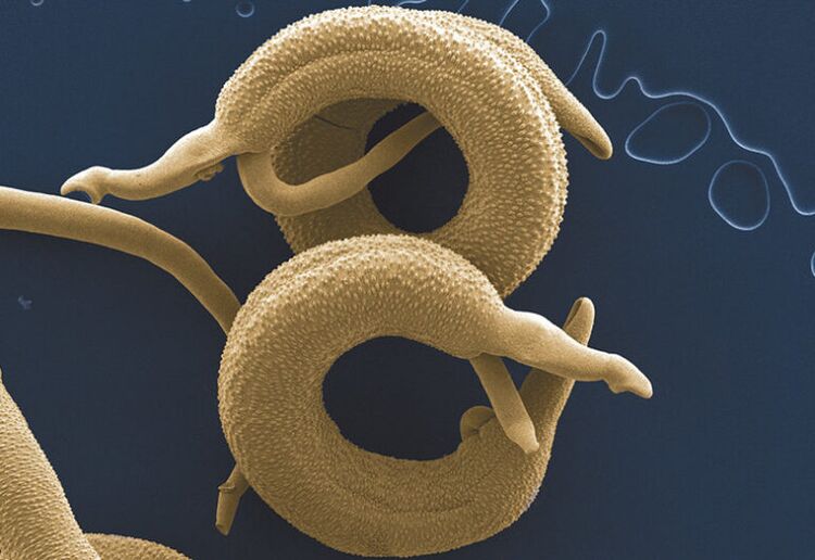 παράσιτα που ζουν στο ανθρώπινο σώμα