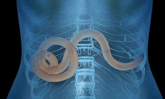 παράσιτο στο ανθρώπινο σώμα